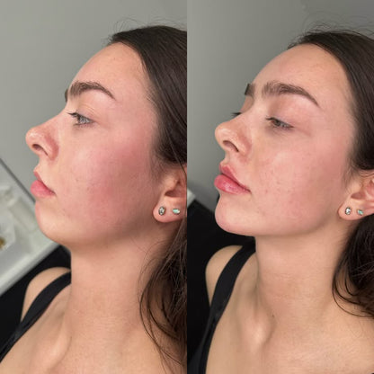 Aura Glow™ Gesichtsmassager